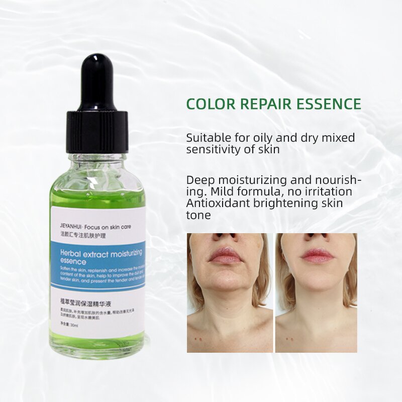 Face Serum Manufacturer - Red Blood Spot Corrector Private Label Natural Acne Scar Removal Treatment