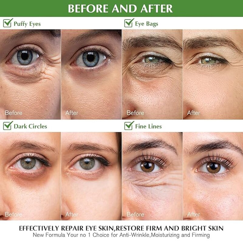 Eye Mask Manufacturer - OEM/ODM General Collagen Dark Circle Hydrating Hydrogel Anti Wrinkle Eye Mask