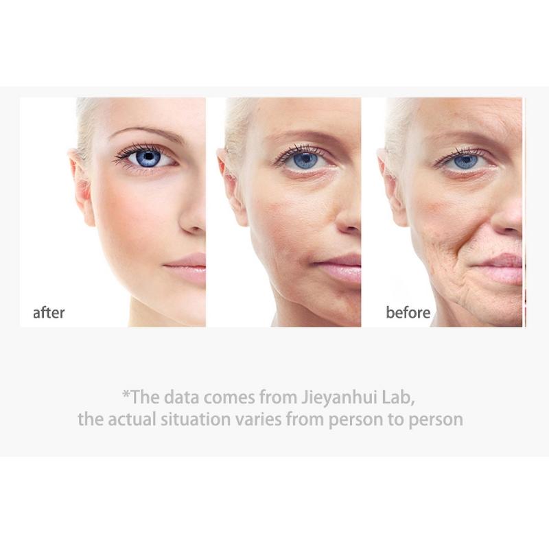 Cream Manufacturer - OEM Best Selling Herbal Spot Blemish Freckle Removal Anti-Wrinkle Whitening Cream