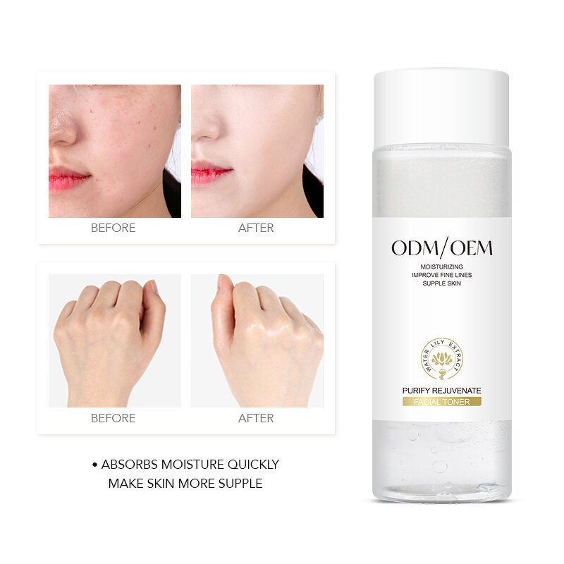 Facial Toner Manufacturer - Private Label Plant Extract Toner Repair Fine Lines Moisturizing Vegan Organic