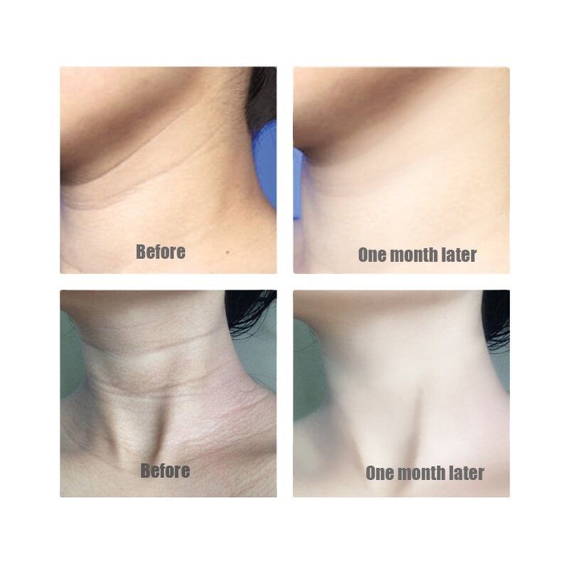 Neck Cream Manufacturer - Anti Aging Neck Cream Anti Wrinkle Nourishing Neck Mask Tighten Lift Firming