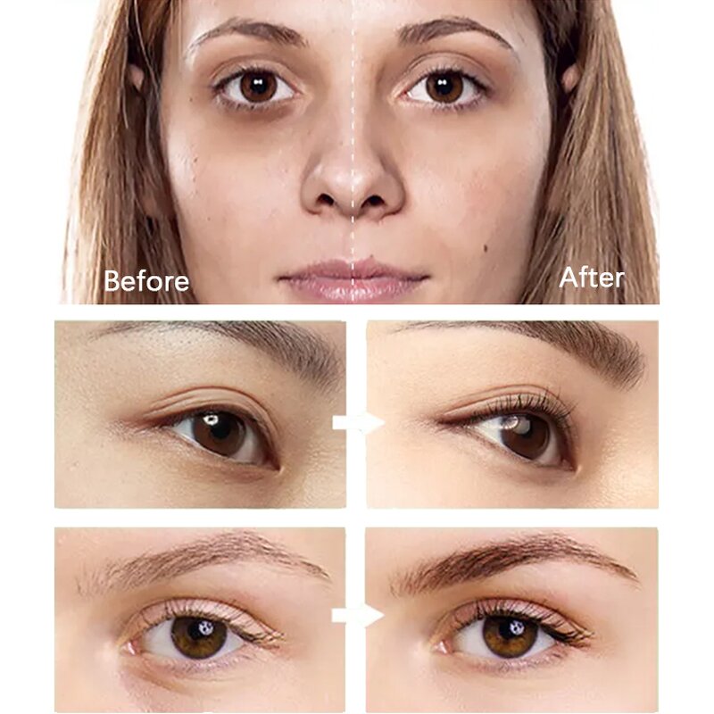 Eye Cream Manufacturer - Wholesale Korean Private Label Anti Wrinkle Anti Aging Dark Circle Treatment