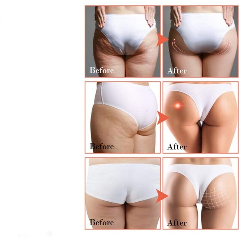 Body Cream Manufacturer - OEM Buttock Enhancement - Firm Smooth Enlargement Sexy Hip