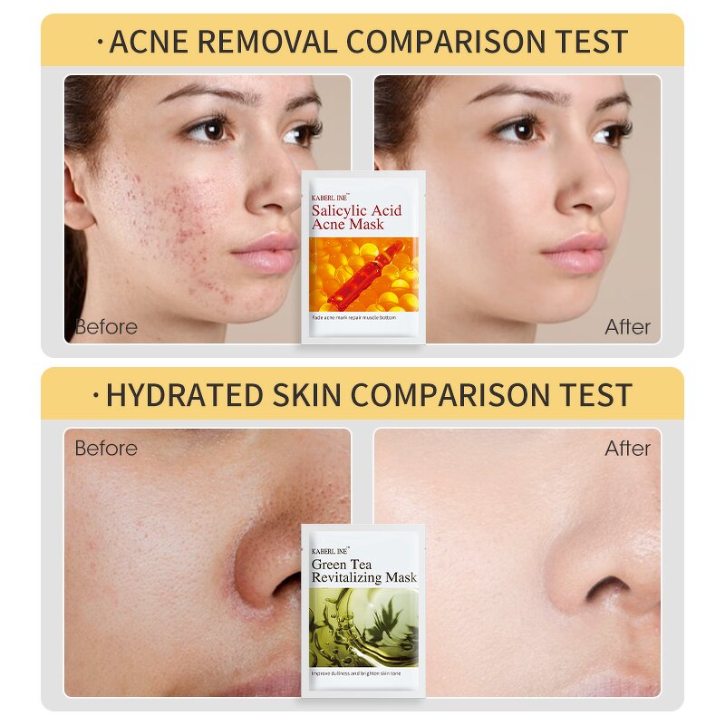 Facial Mask Manufacturer - OEM ODM Custom - Organic Whitening Anti-aging Face Body