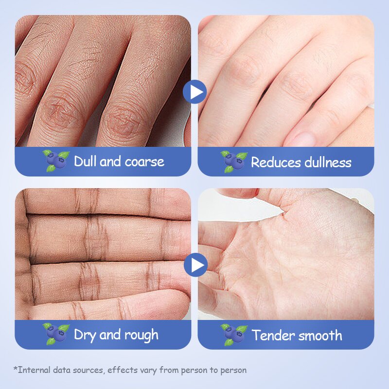 Hand Cream Set Manufacturer - SADOER 5 in 1 - Moisturizing Whitening Blueberry Fruit