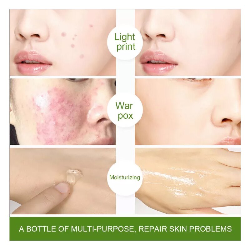 Aloe Vera Gel Manufacturer - 100% Pure Natural Private Label - After Sun Soothing Hydrating