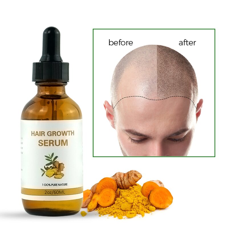 Hair Oil Manufacturer - Private Label - Anti Hair Loss Fast Growth Hot Sale