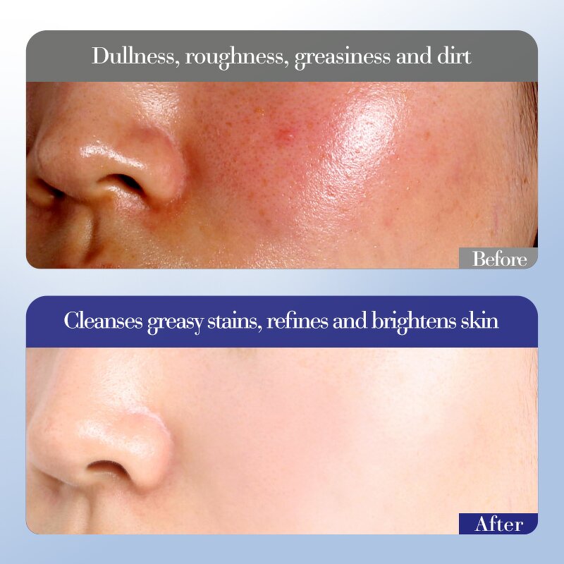 Skin Care Set Manufacturer - SADOER Vitamin E 6-piece - Brightening Moisturizing Organic Korean