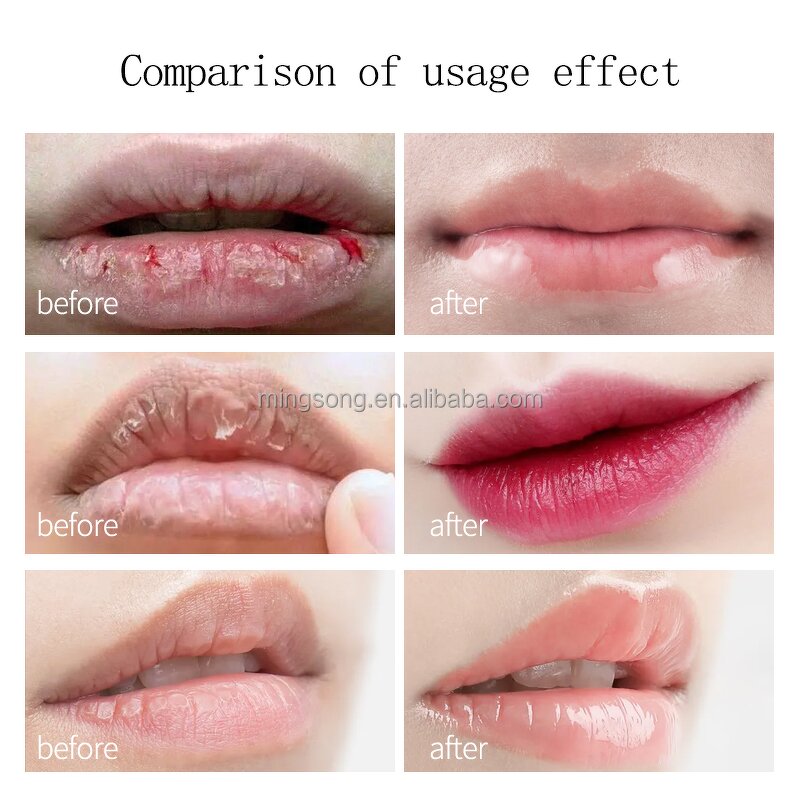 Lip Mask Manufacturer - Collagen Rose Private Label - Pink Gel Patch Custom Wholesale