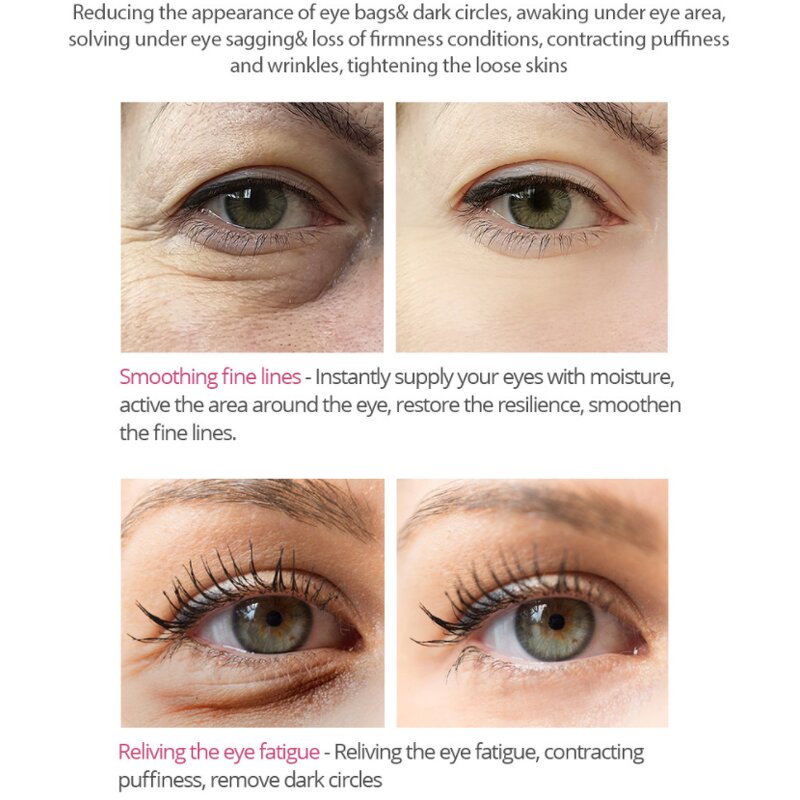 Eye Serum Manufacturer - Wholesale Anti-Wrinkle - Remove Dark Circles Vitamin C