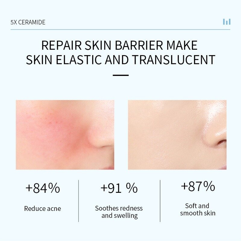 Moisturizing Cream Manufacturer - 70% Ceramide with Peptides for Body Face & Customized