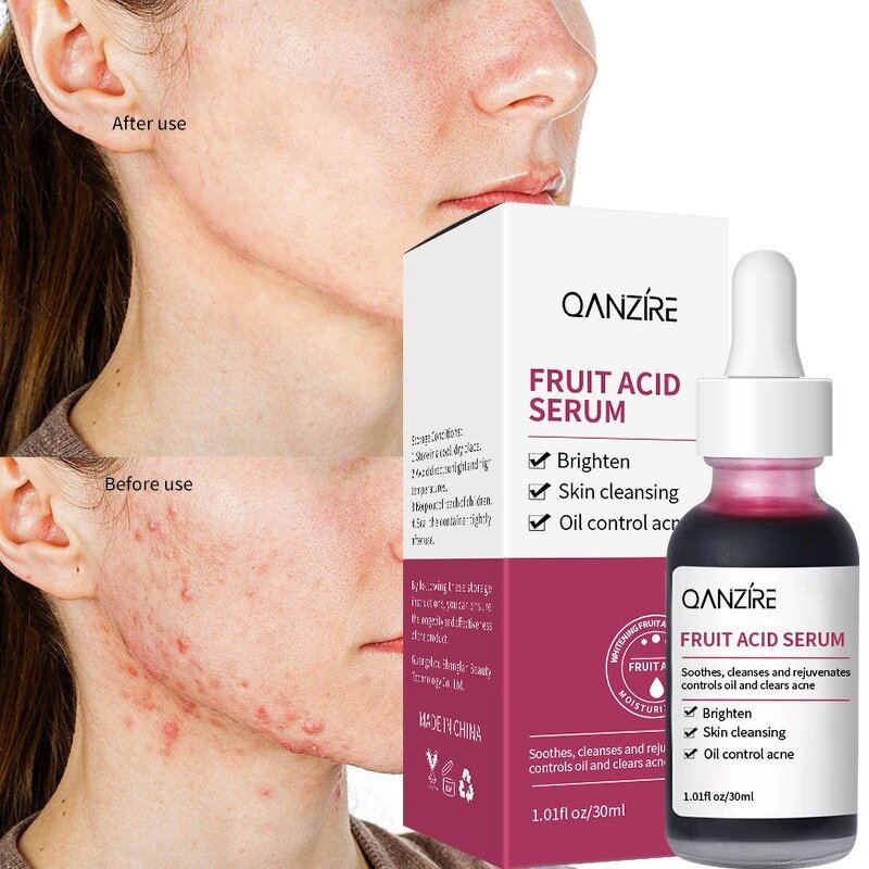 Essence Serum Manufacturer - Acid Fruit for Acne Removal Softening Cuticles