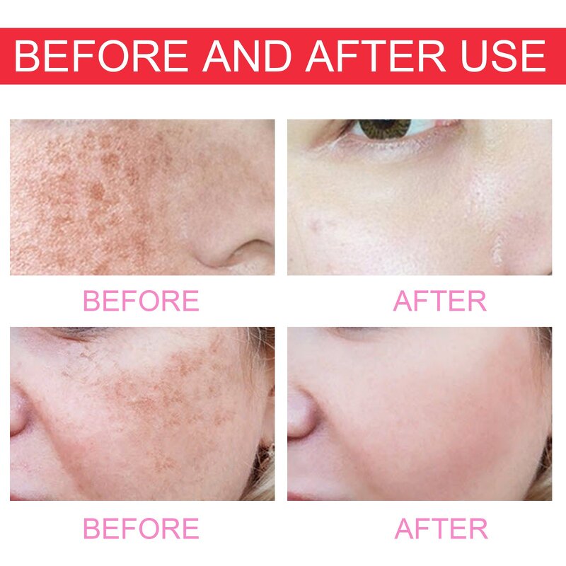 Serum Manufacturer - Original Solution Moisturizing Brightening Clearing Body Lotion