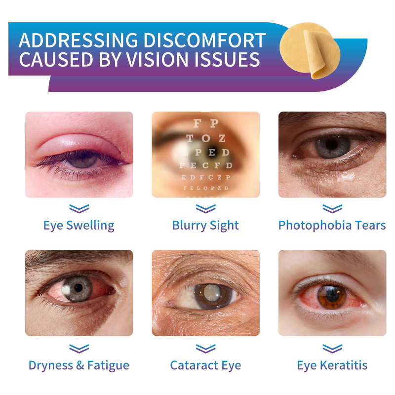 Eye Care Patches Manufacturer - Herbal for Dry Eyes Fatigue Relief Sleep-Protective Gel