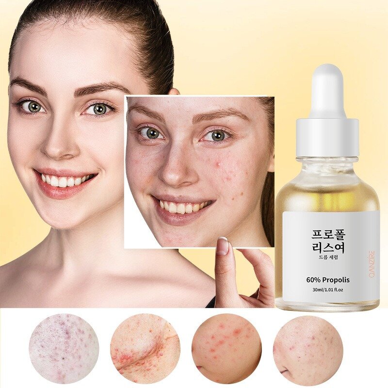 Radiance Serum Manufacturer - Propolis Niacinamide Korean Skin Care & Wholesale