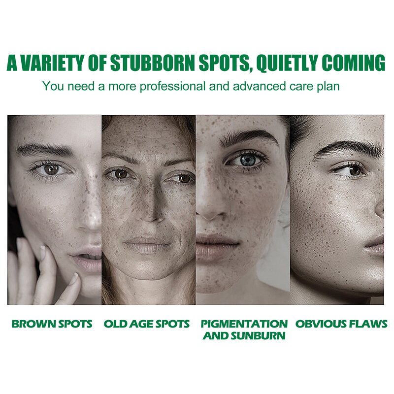 Dark Spot Serum Manufacturer - Correcting Glow for Hyperpigmentation Fine Lines