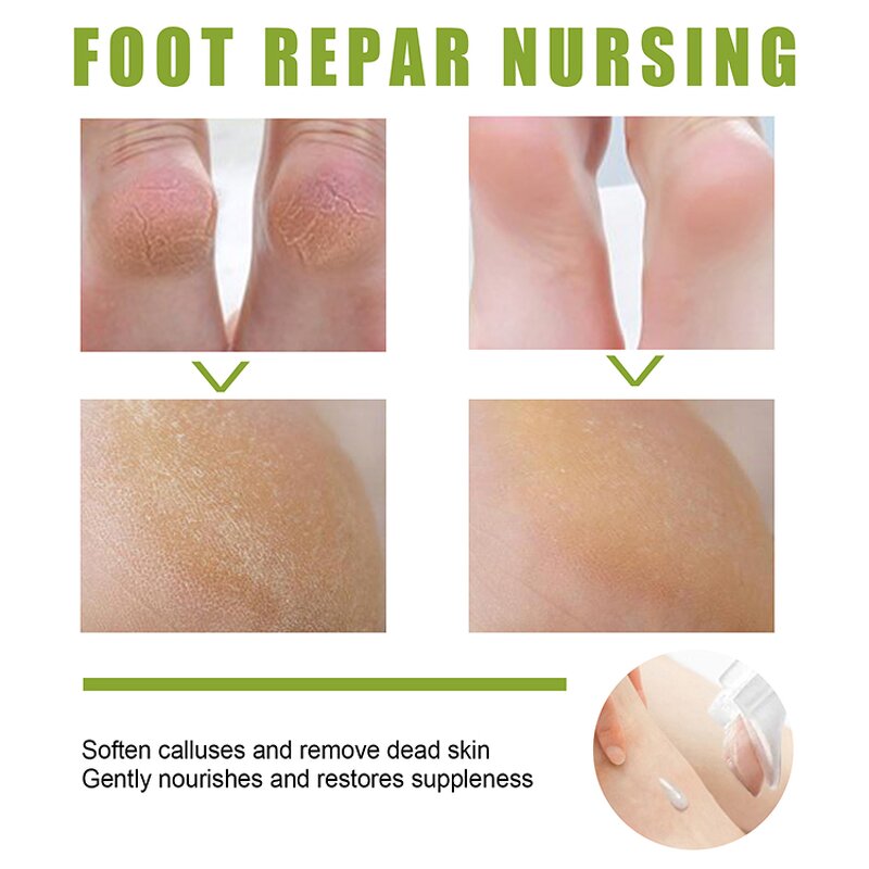 Foot Spray Manufacturer - Collagen Infused - Tea Tree Oil Exfoliating Repair Dead Skin Calluses Black Skin