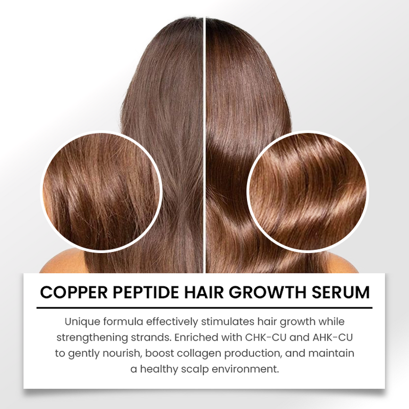 Hair Growth Serum Manufacturer - Organic Ghk-Cu - Hyaluronic Acid Blue Copper Peptide Nourishing Hair Loss