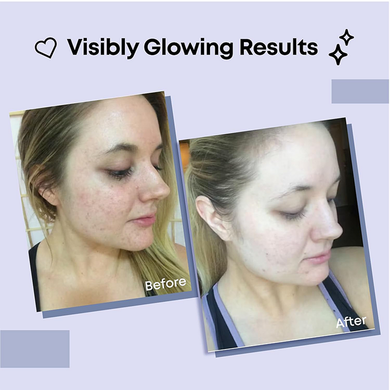 Facial Mask Manufacturer - OEM Deep Collagen Hydration - Niacinamide Pear Vitamin C Moisturizing