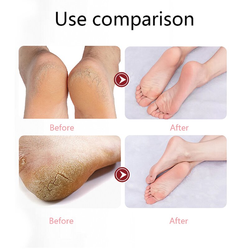 Foot Mask Manufacturer - Niacinamide Goat Milk - Plant Extracts Repair Nourishment Skin Care
