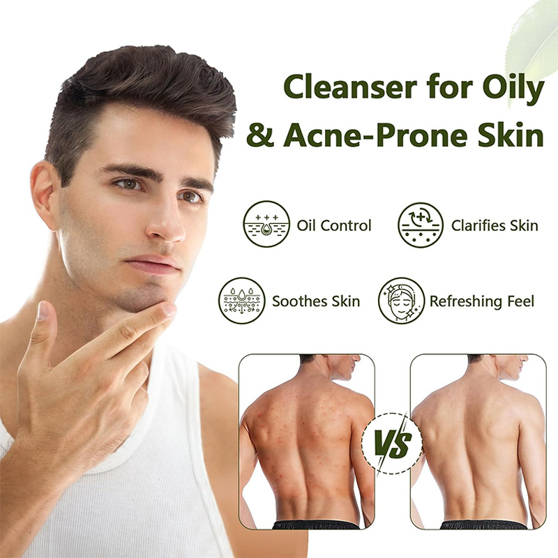 Handmade Soap Bar Manufacturer - Herbal Relief - Olive Oil Tea Tree Oil Shea Butter Cleansing Oil Control