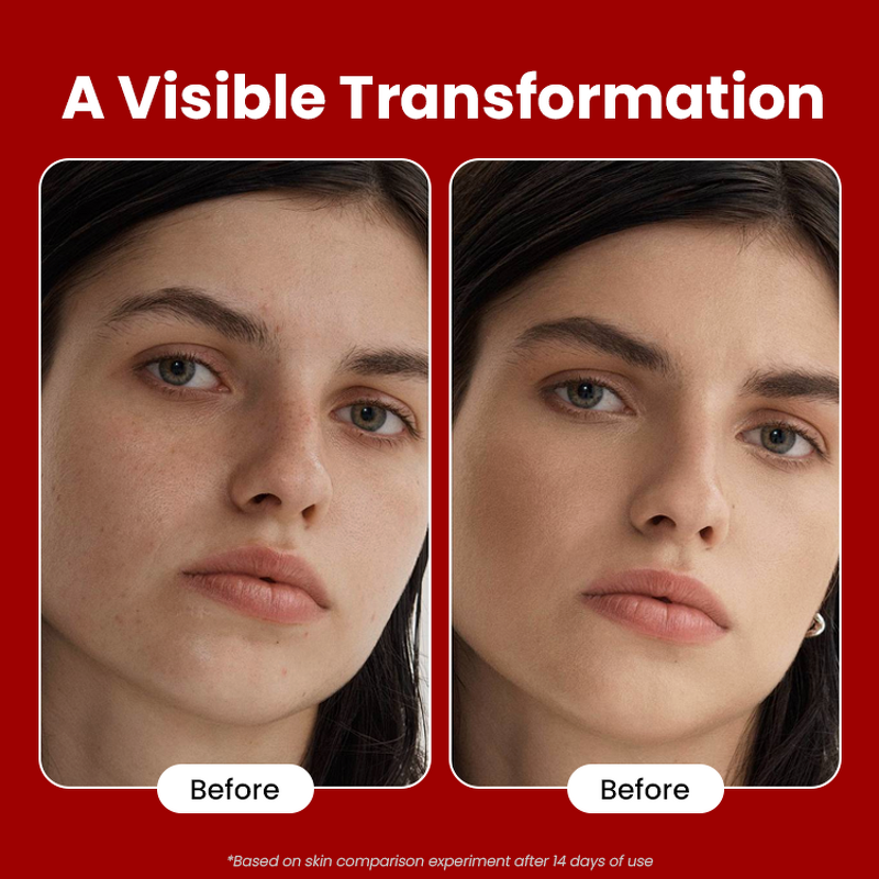 Niacinamide Serum Manufacturer - Christmas Limited Edition - Skin Brightening Glow Tightening Moisturizing