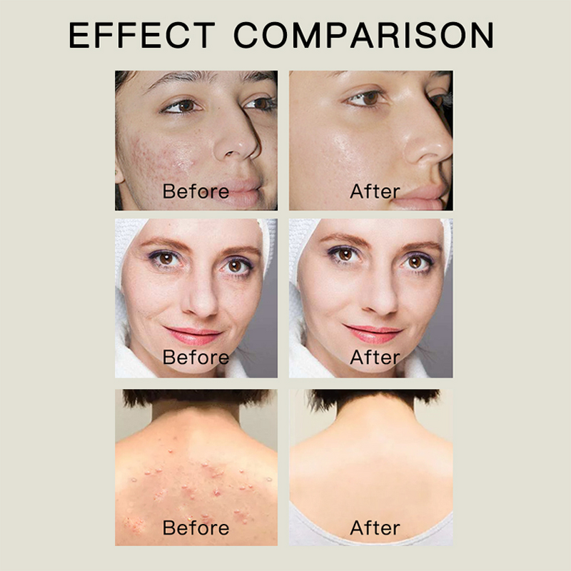 Soap Bar Manufacturer - Camellia Ginger - Handmade Nourishing Turmeric Aloe Charcoal Oil Control