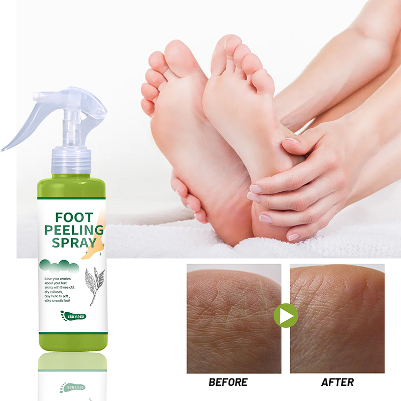Foot Spray Manufacturer - Collagen Infused - Tea Tree Oil Exfoliating Repair Dead Skin Calluses Black Skin