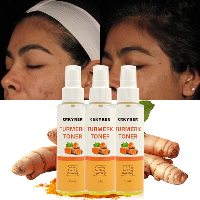 Facial Toner Manufacturer - OEM Organic Turmeric - Aloe AHA Whitening Anti Acne Fades Blemishes