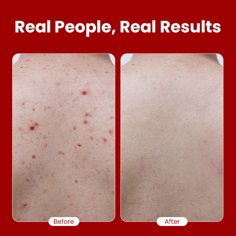 Body Scrub Manufacturer - Christmas Limited Edition - Deep Cleanse Jojoba Seed Oil Camellia Sinensis Gentle Exfoliation