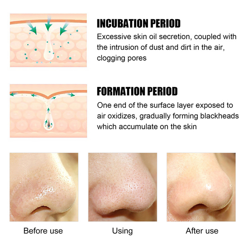 Face Soap Manufacturer - 100% Natural Bamboo Charcoal - Deep Purifying Exfoliator Black Mud Wholesale