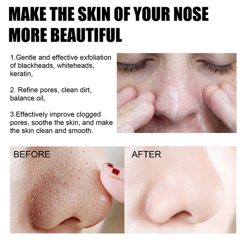 Face Soap Manufacturer - 100% Natural Bamboo Charcoal - Deep Purifying Exfoliator Black Mud Wholesale