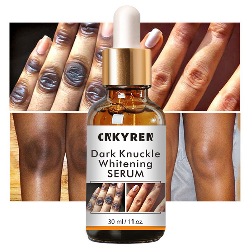 Serum Manufacturer - Dark Knuckles Fast Whitening - Allantoin Niacinamide Elastic Smooth Knee Repair