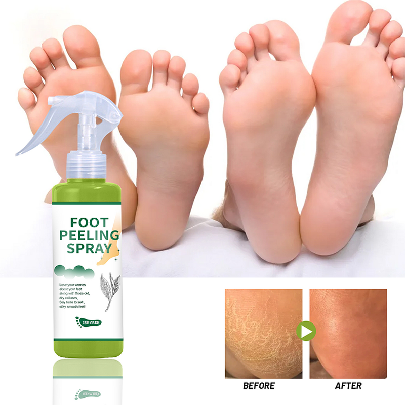 Foot Spray Manufacturer - Collagen Infused - Tea Tree Oil Exfoliating Repair Dead Skin Calluses Black Skin