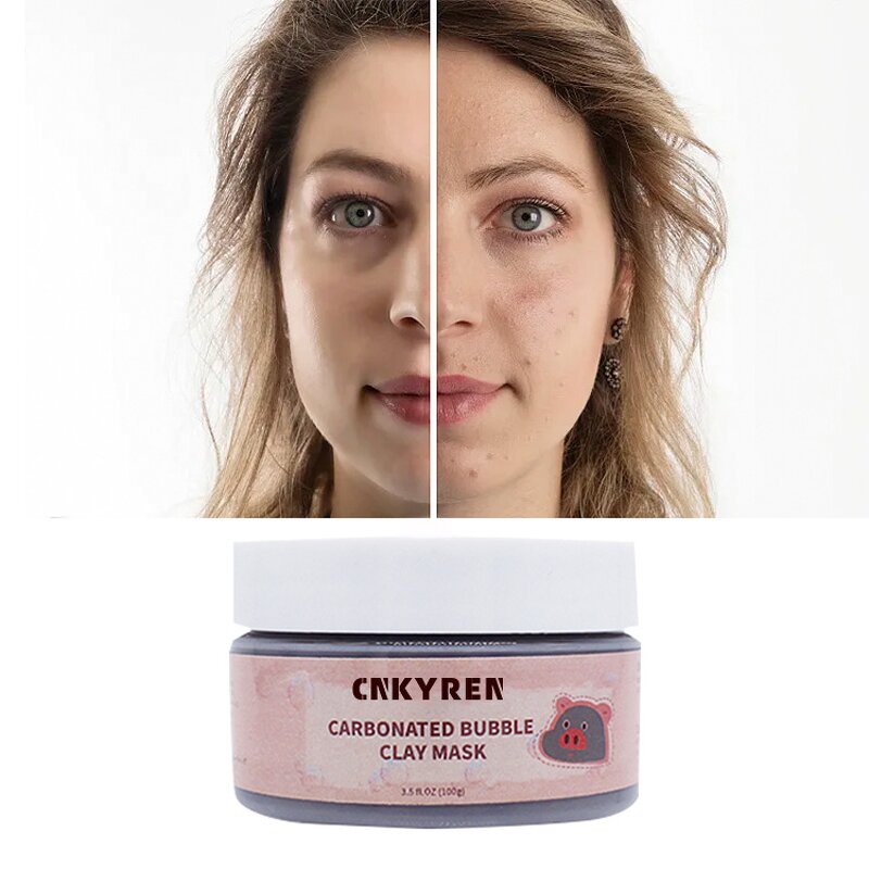 Facial Mask Manufacturer - OEM Carbonated Bubble - Anti Acne Anti Wrinkle Pore Cleaner Collagen Hyaluronic Acid