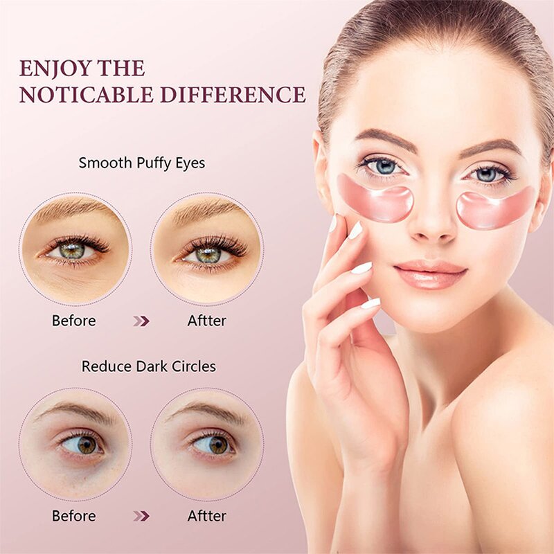 Eye Gel Patches Manufacturer - Rose Vegan - Collagen Sodium Hyaluronate Moist Smooth Reduced Wrinkles