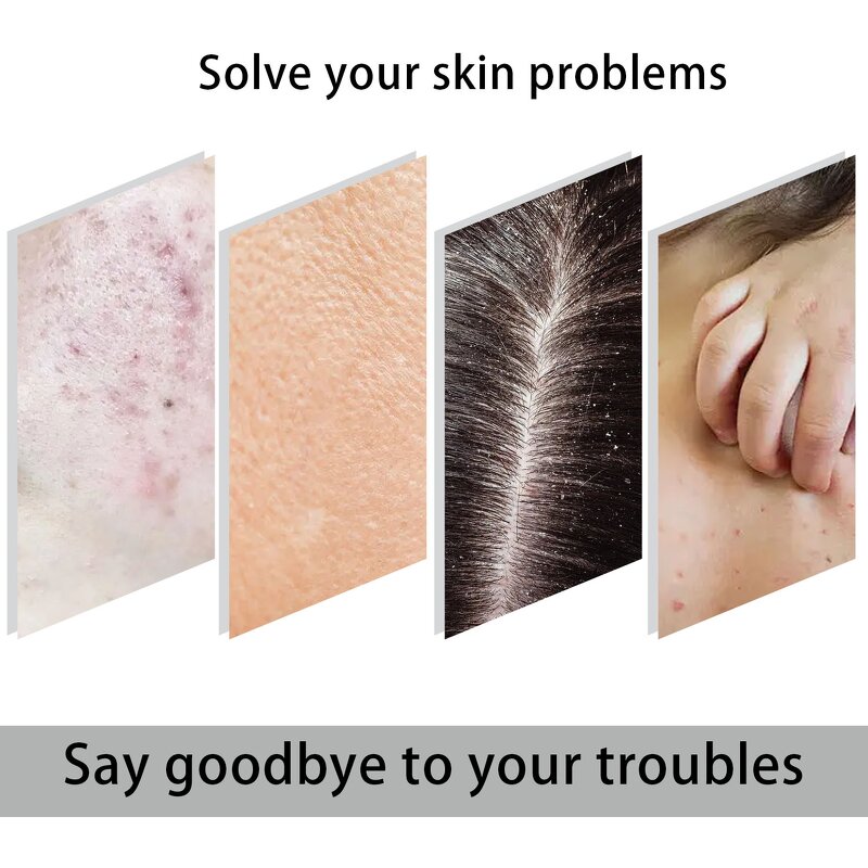 Soap Manufacturer - Whitening Turmeric Glutathione Kojic Acid Deep Cleaning Bleaching Anti Acne Adults