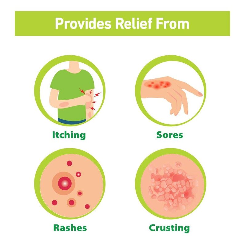 Soap Manufacturer - 100g Adults Medicated Glycerin Whitening Kojic for Fighting Skin Infections Itching