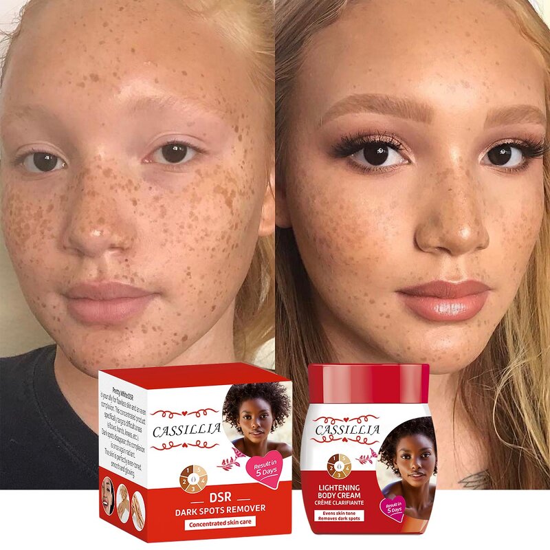 Body Cream Manufacturer - Private Label Organic Hyaluronic Acid Lightening Niacinamide Bleaching Remove Dark Spots Butter