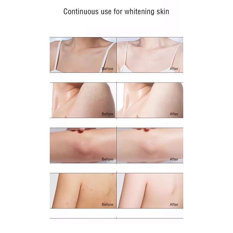 Body Oil Manufacturer - Luxury Organic Body Essential Oil Tea Tree Orange Jasmine Skin Clarifying Knuckle