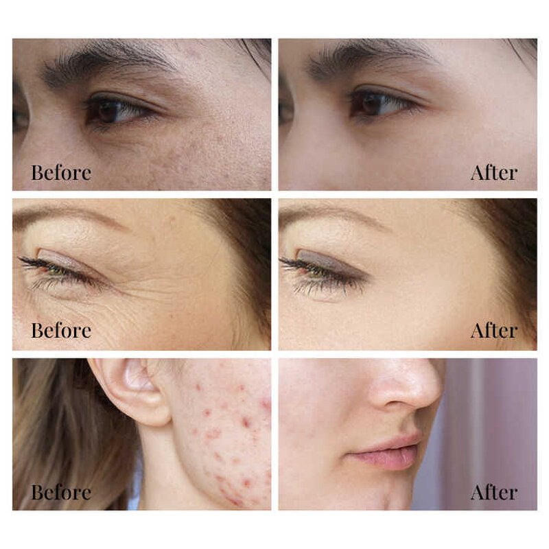 Skin Care Serum Manufacturer - with Vitamin C Niacinamide Retinol Hyaluronic Acid Bakuchiol Kojic Acid Alpha Arbutin Salicylic Acid