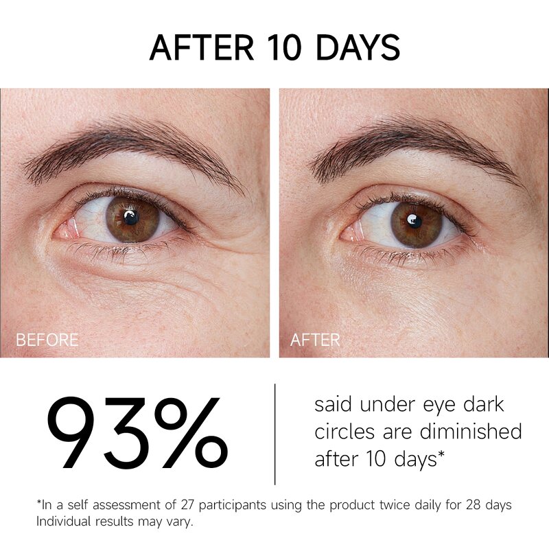 Eye Cream Manufacturer - Retinol Bakuchi for Bags Removal Anti Wrinkles Anti Age & Private Label 2025