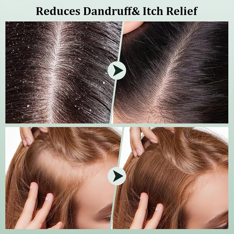 Scalp Scrub Manufacturer - Sea Salt Mint Tea Tree Anti-Dandruff with Rosemary Oil Massager