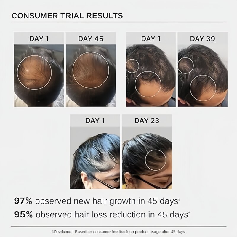 Hair Growth Shampoo Set Manufacturer - 3% Redensyl Procapil Anagain Anti Hair Loss & Hot Seller 2025