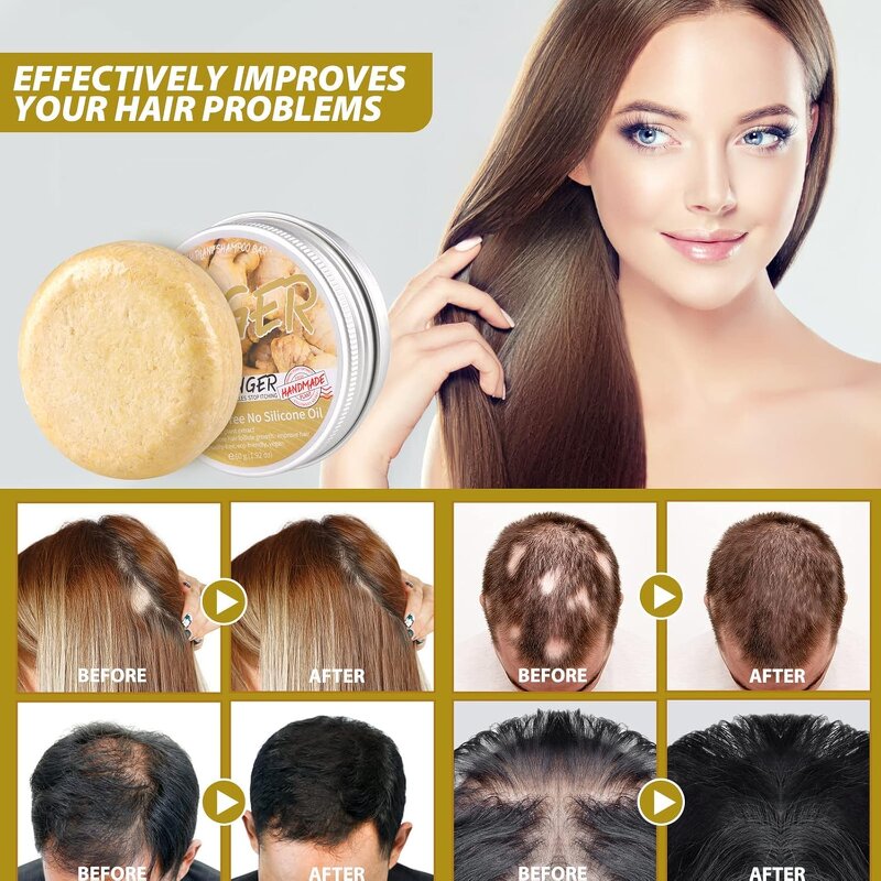 Hair Shampoo Bar Manufacturer - 2025 ODM Hair Growth Ginger Deep Cleaning Anti Hair Loss Bar Soap