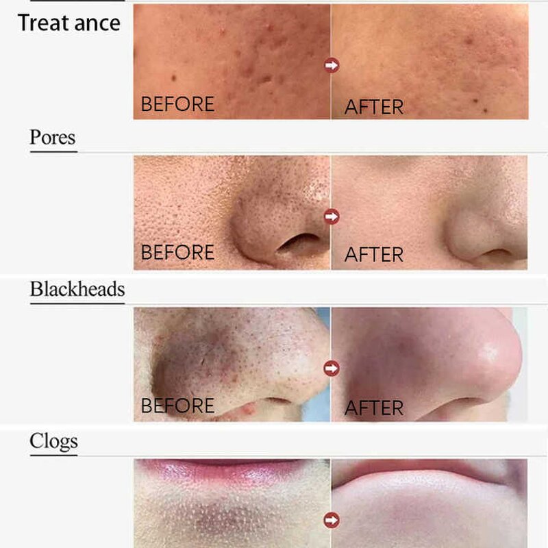 Facial Cleanser Manufacturer - Snow Lotus Vitamin C 100% Natural Organic Soothing Foaming Deep Cleansing Whitening