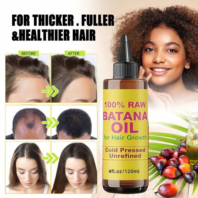 Hair Shampoo Set Manufacturer - Batana Oil Anti-hair Loss Mask Conditioner Promotes Growth Thicker & OEM