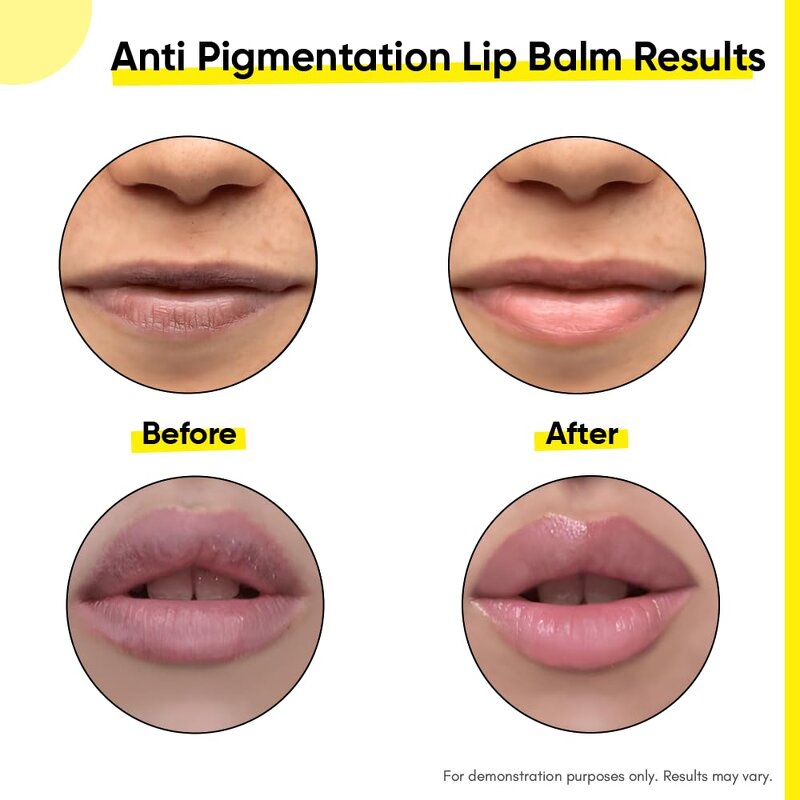 Lip Sleeping Mask Manufacturer - Korean Repairing Lip Lines with Hyaluronic Acid Retinol Cute Nourishing Balm & OEM