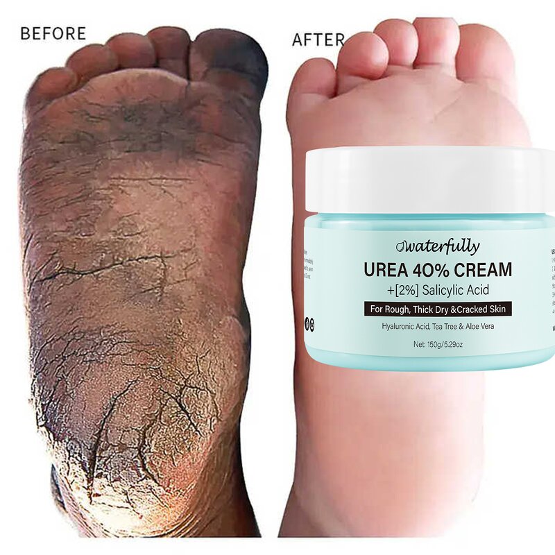 Foot Cream Manufacturer - Moisturizing Custom Moisture Organic for Cracked Heels & OEM