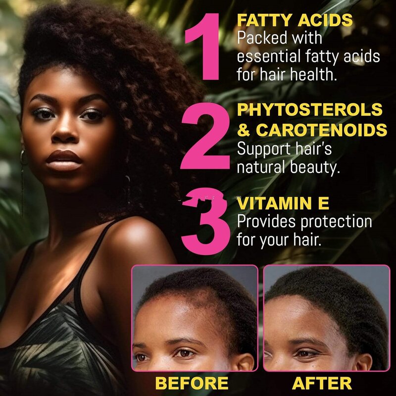 Hair Shampoo Set Manufacturer - Batana Oil Anti-hair Loss Mask Conditioner Promotes Growth Thicker & OEM